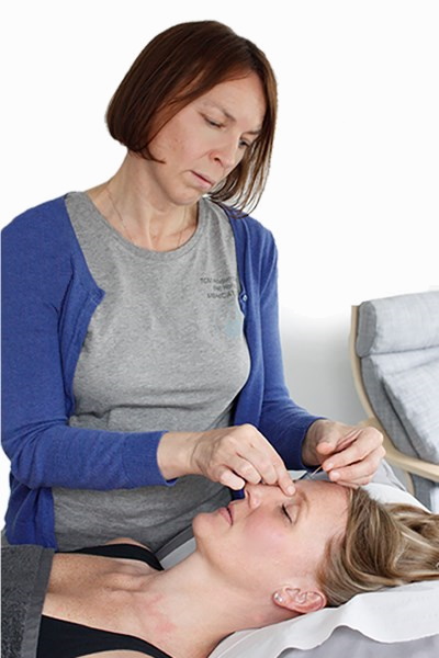 Jenna treating a patient using Acupuncture in her Wilmslow clinic. Acupuncture near me.